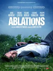 Ablations